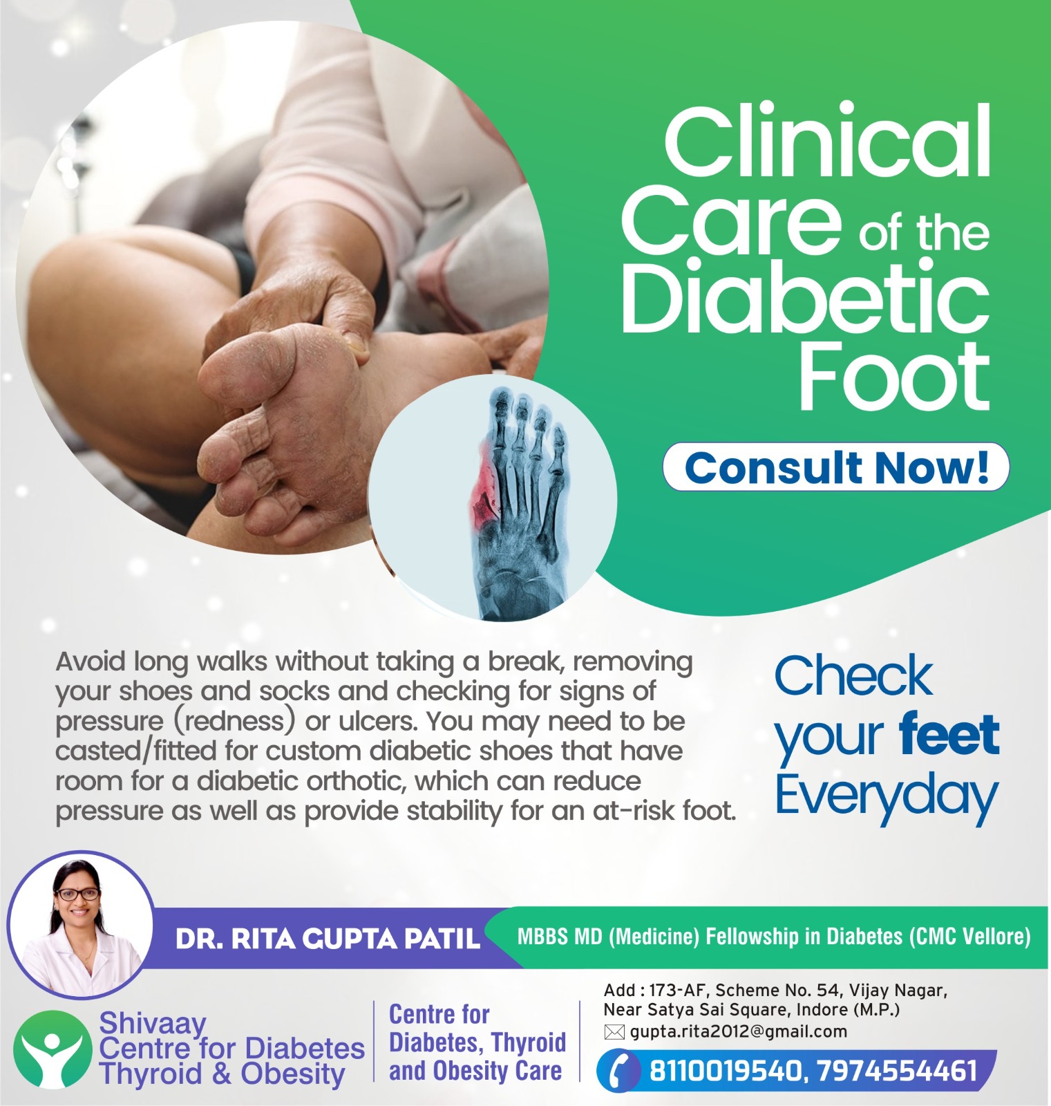 Foot Diabetic Specialist in Indore