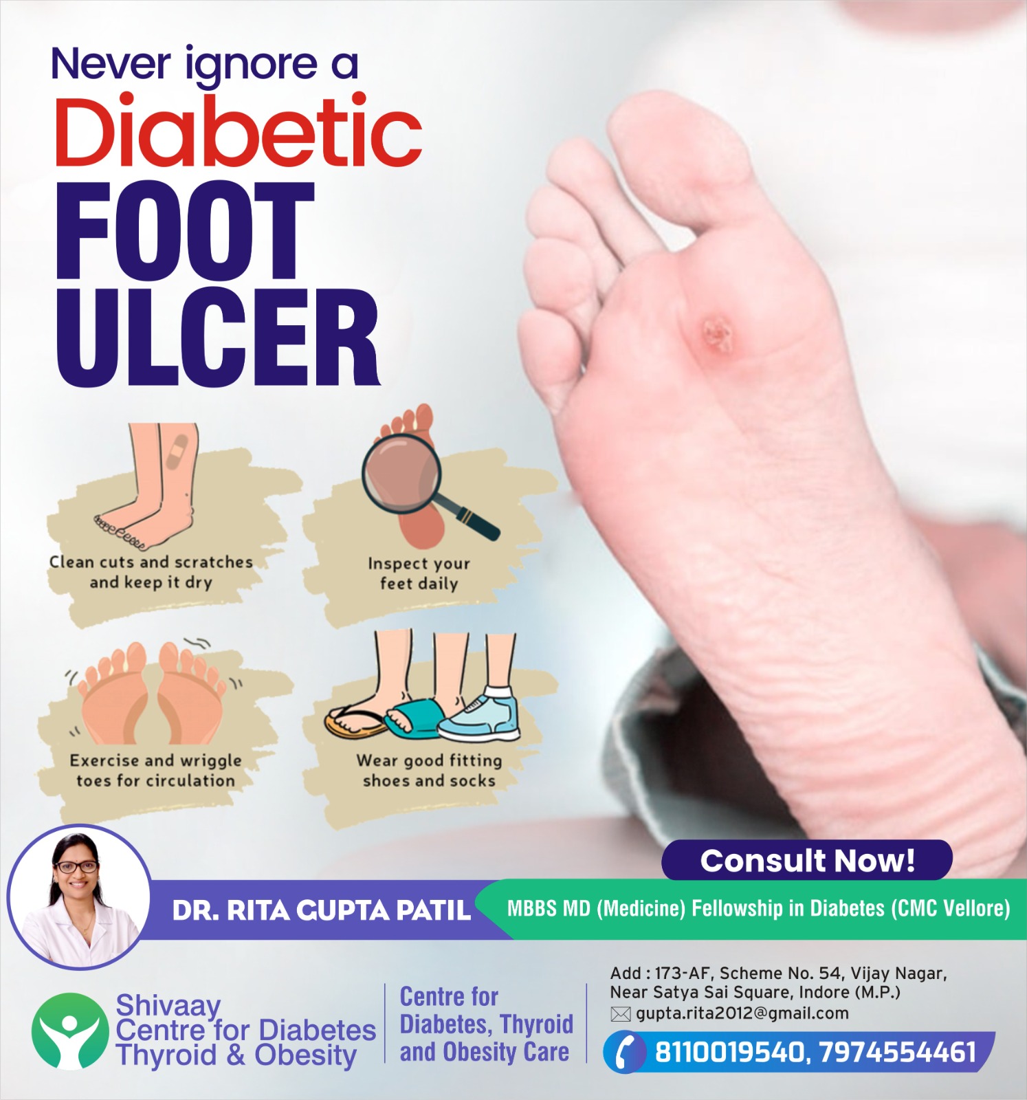 Best Diabetic Foot Ulcer Treatment in Indore