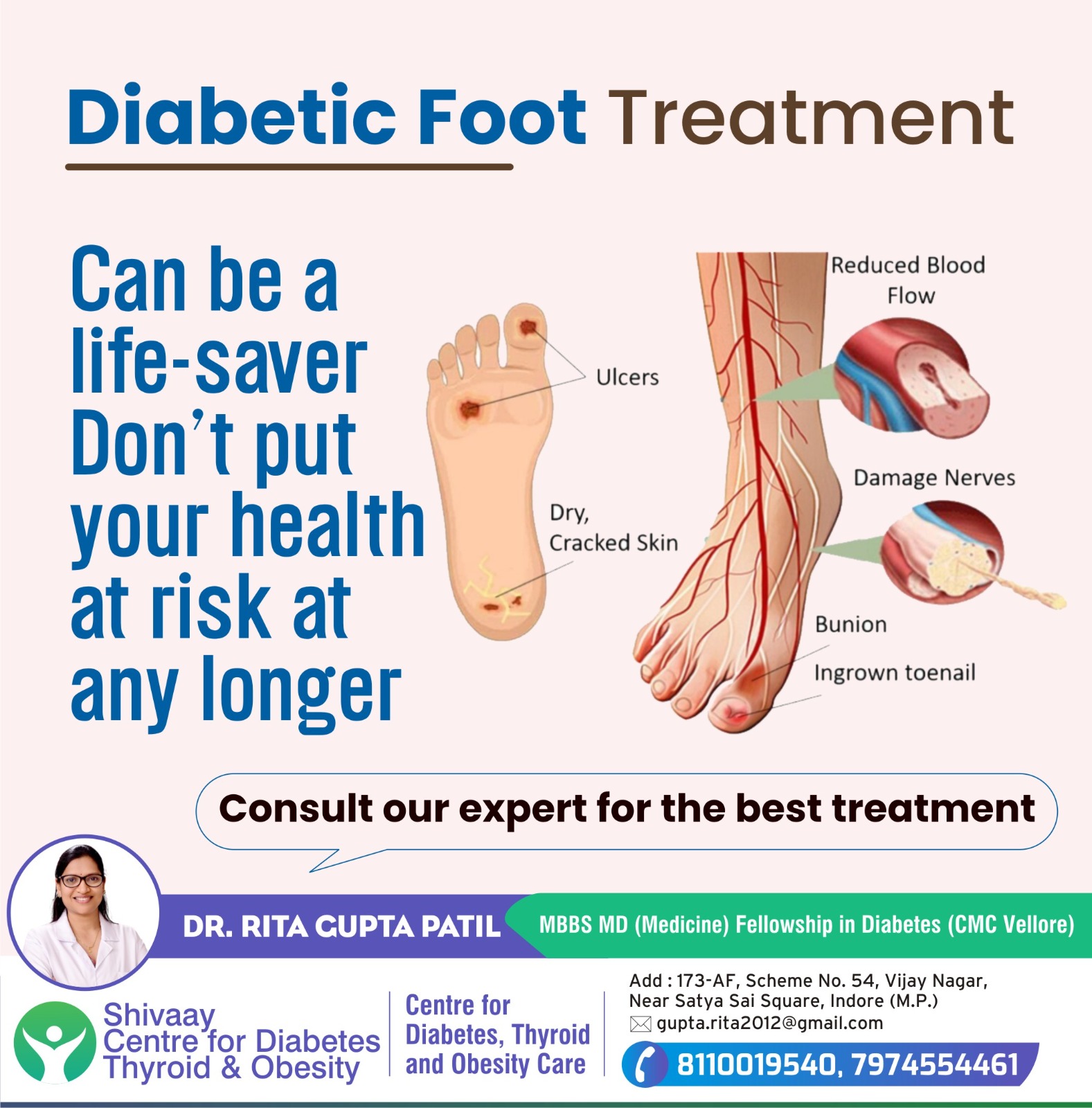 Best Doctor for Diabetic Foot Treatment in Indore