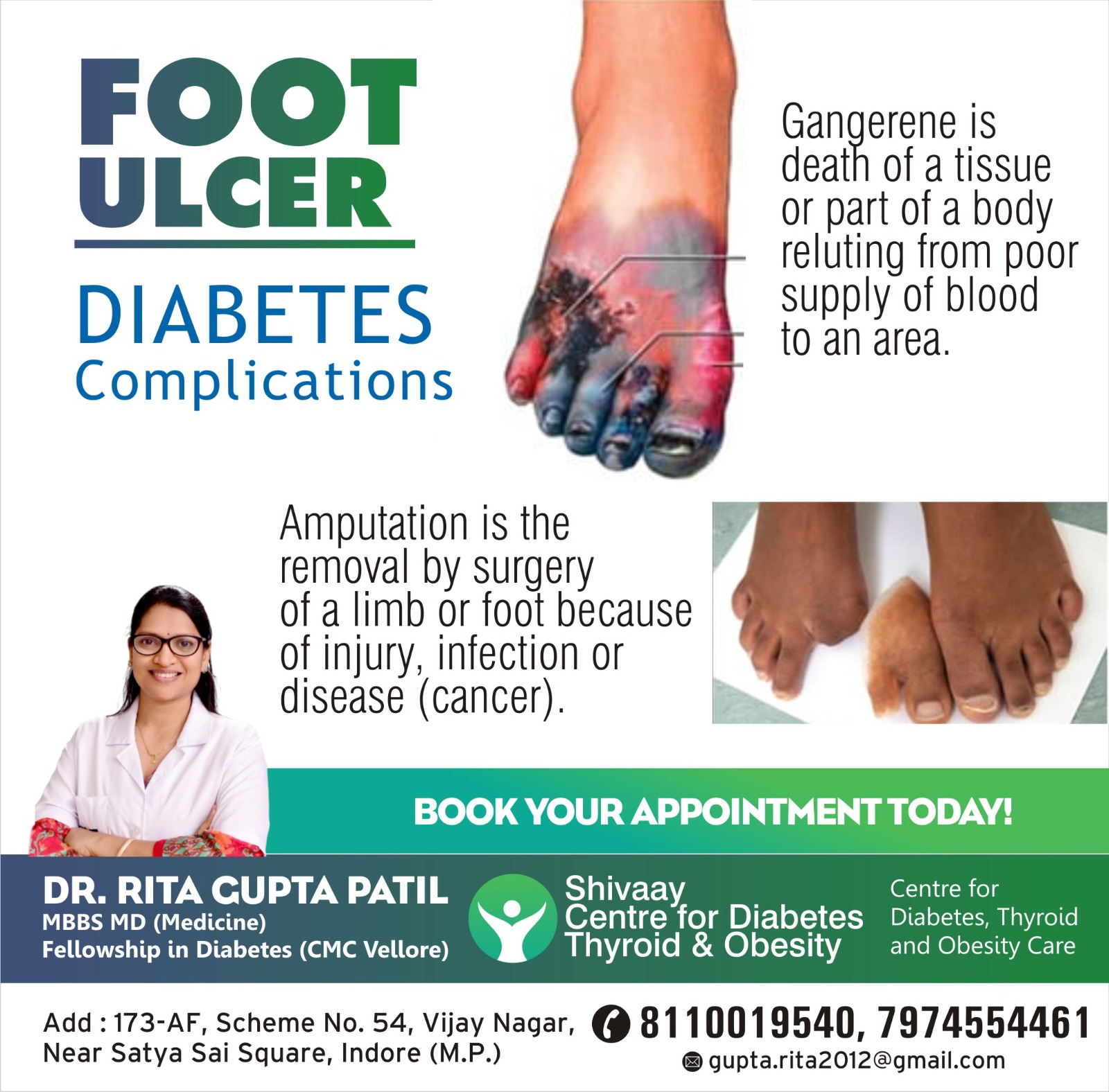 Diabetic Foot Ulcer - ConvaCare Clinics | Wound Care Clinic in Johannesburg
