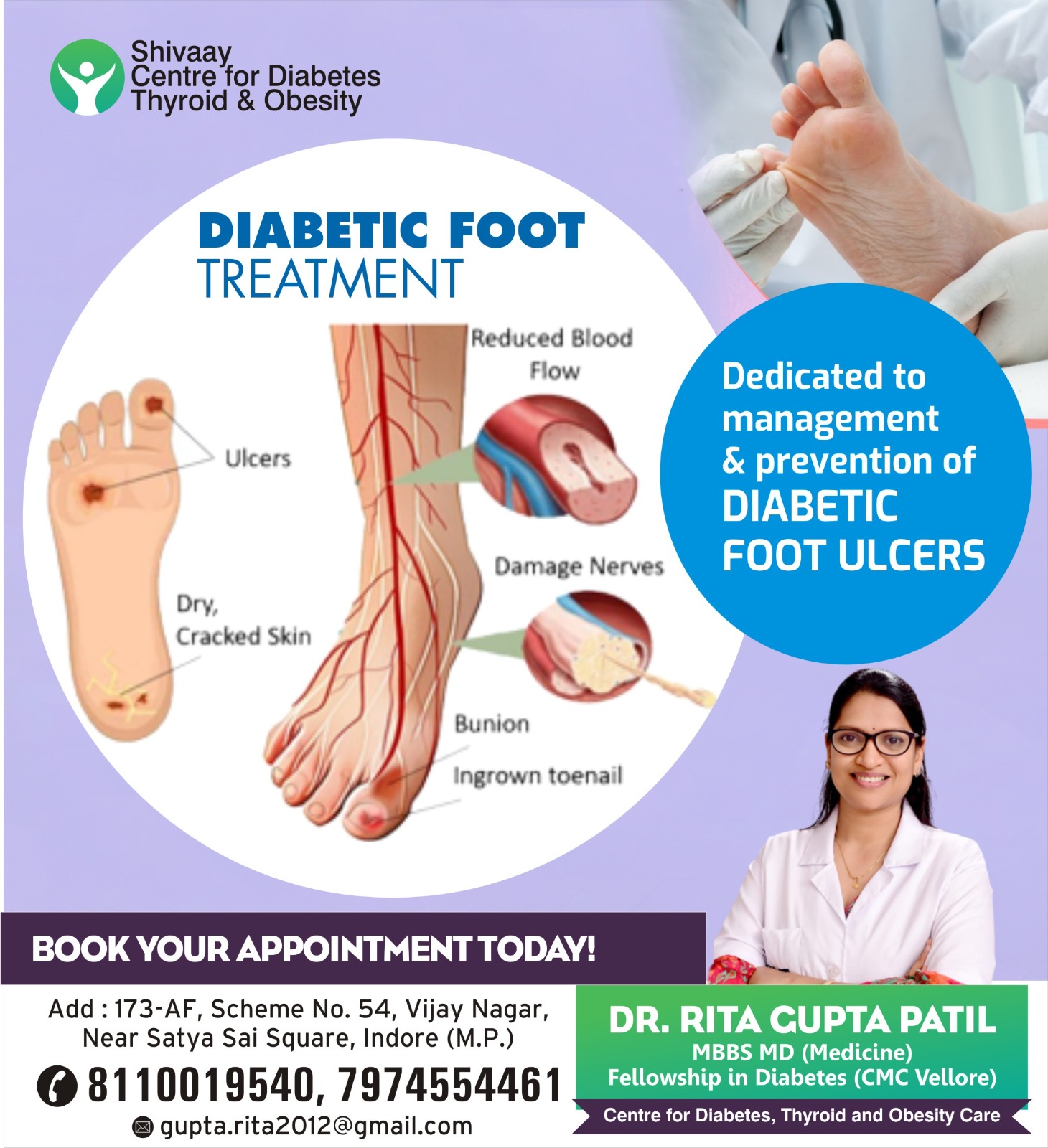 Foot Diabetic Treatment in Indore