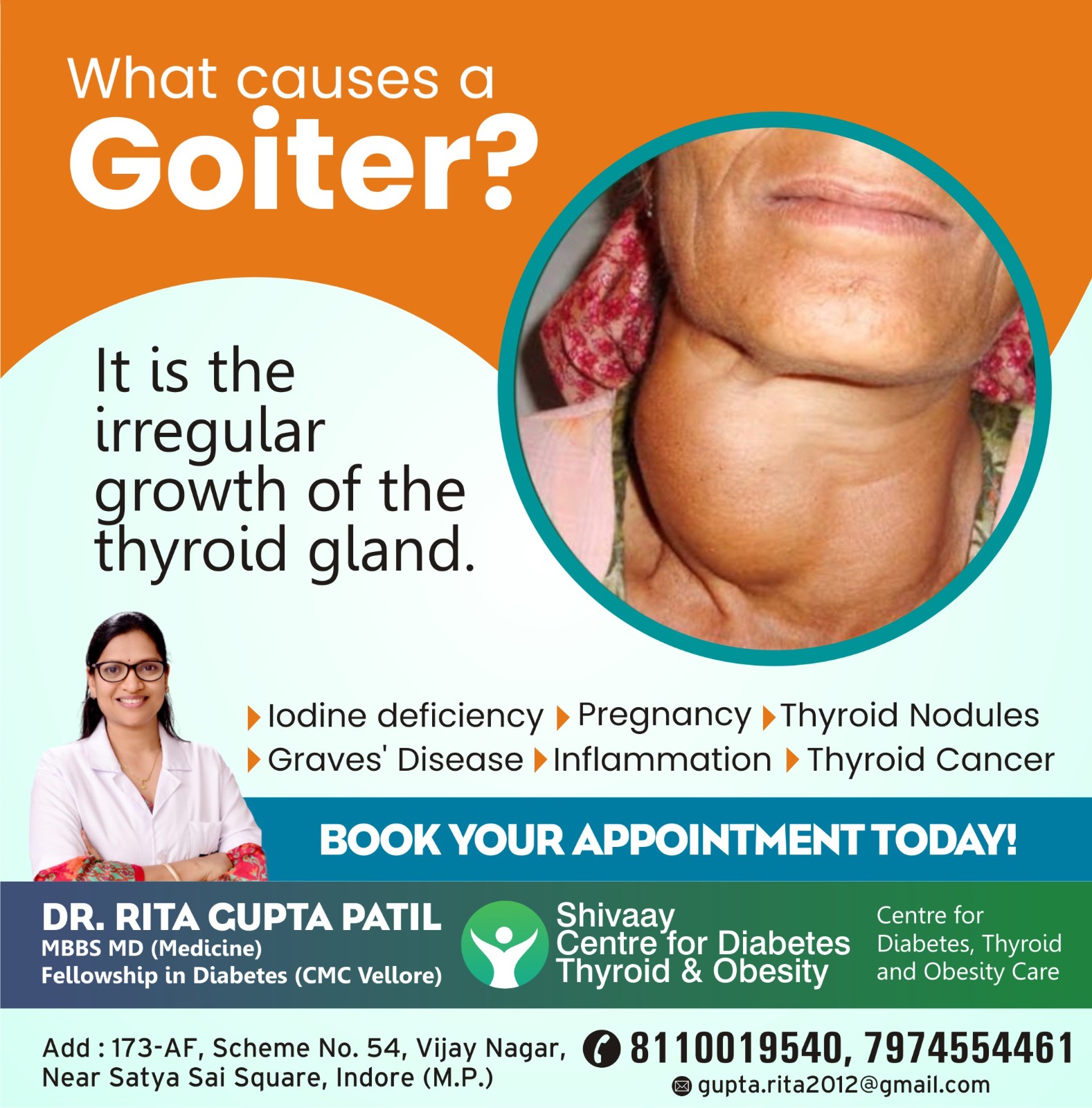 Best Doctor for Goiter Treatment in Indore